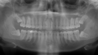 Pret radiografie panoramica