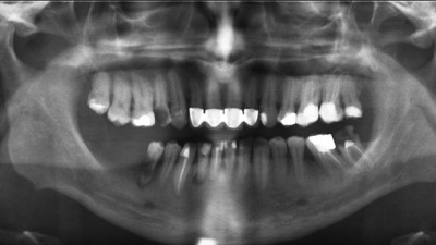 Preț radiografie dentară