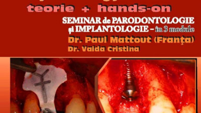Master in Periodontology & Implantology with Paul MATTOUT