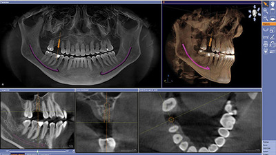 Introducere în imagistica stomatologică - CBCT