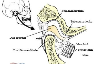Anchiloza temporo-mandibulara