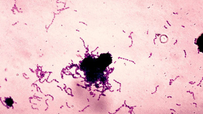 Microorganismele cariogene