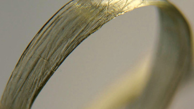 Fibrele schimba stomatologia?