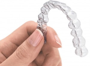 Alternativa aparatelor dentare fixe si mobile - Invisalign