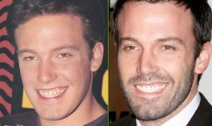 Ben Affleck stomatolog