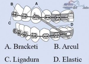 Componente aparat dentar