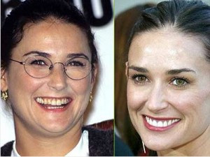 Demi Moore stomatolog