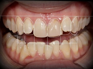 DigitalSmileDesign