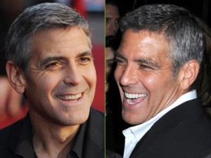 George Clooney stomatolog