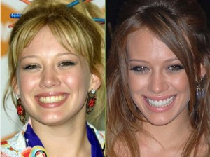 Hilary Duff stomatolog