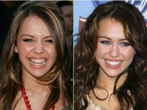 Miley Cyrus stomatolog
