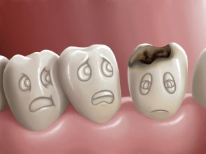 caria-dentara