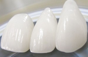 fatete dentare 2