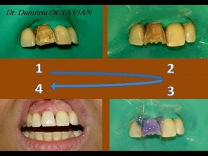 fatete dentare