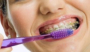 igeinizarea aparatului dentar