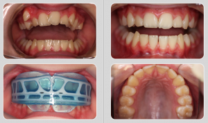 k3_case1_slide3-900x675