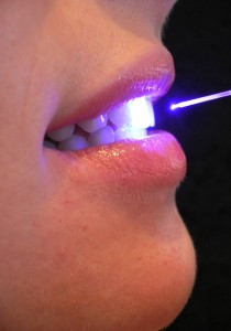 laser stomatologic