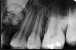 pret radiografie retroalveolara