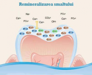 remineralizare dinte