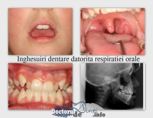 respiratia orala