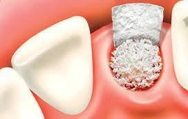 rezidentiat medicina dentara