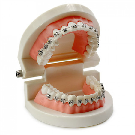 Model dentar educational 28 dinti cu aparat dentar