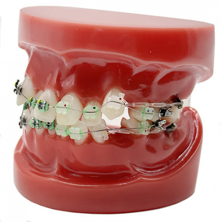 Model educational ortodontic YL-B1-02