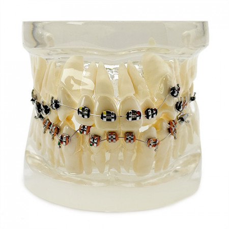Model ortodontic transparent canin ectopic YL-B5-01