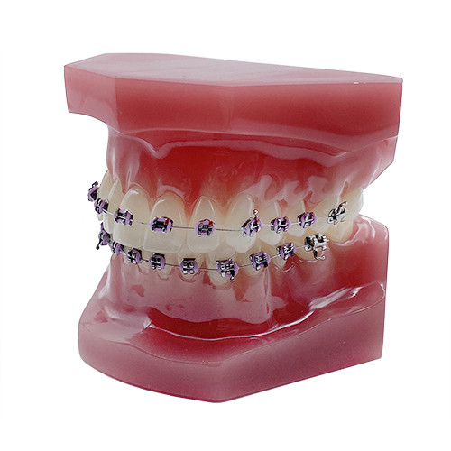 Model educational aparat ortodontic metalic 009