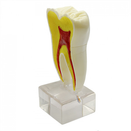 Model educational morfologie dentara molar YL-C20
