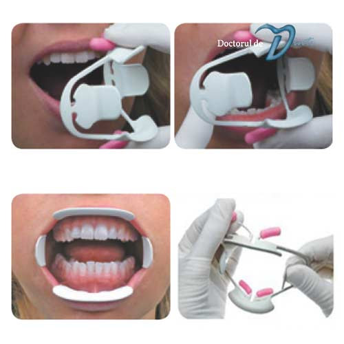 Optiview Retractor Departator retractor buze si obraji model Optiview