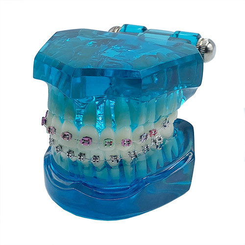 Model educational aparat ortodontic metalic 005