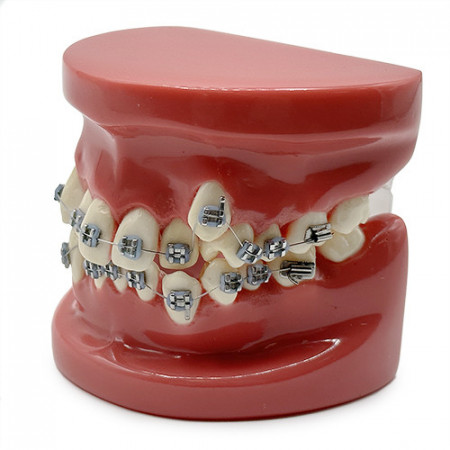 Model educational ortodontic YL-B1-01