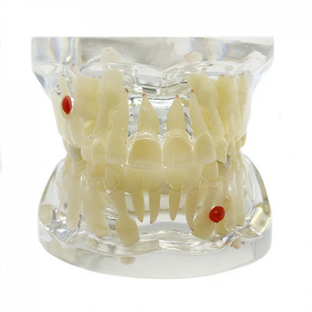 Model pedodontic dentitie mixta cu patologii YL-C5