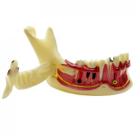 Model educational mandibula sectionata YL-N14