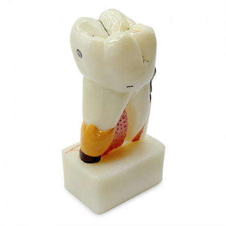 Model educational patologii dentare YL-C17