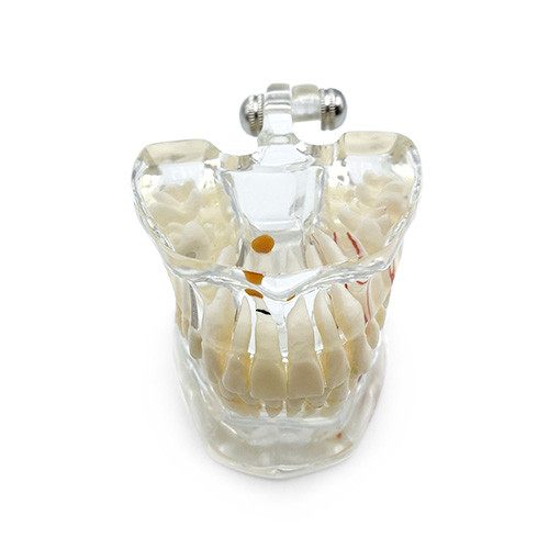 Model educational patologii dentare 31 dinti