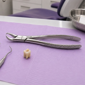 Cleste Extractie Molari Inferiori Nr 87 Coroane Distruse - Img 2