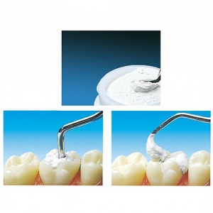 Coltosol F Ciment Single Pack 38g Coltene