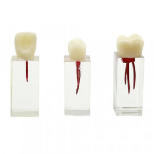 Endo block transparent si coroana YL-N5 3buc