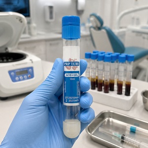 Eprubeta PRP Vacutainer 10ml Plasmolifting - Img 2