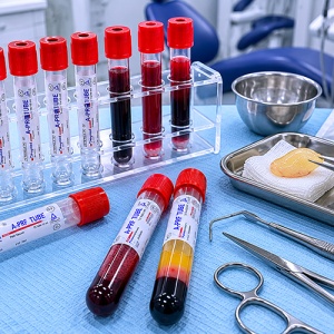 Eprubete A-PRF Vacutainer 10 ml Keymed 50buc - Img 2