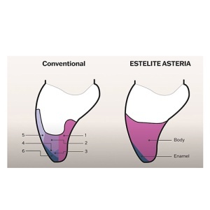Estelite Asteria - 4g tooth