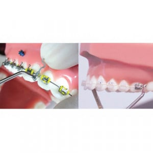 Instrument indoit capat distal arc ortodontic