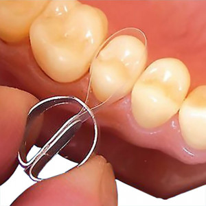 Kit matrici dentare celuloid conturate cu clema 1096 32buc