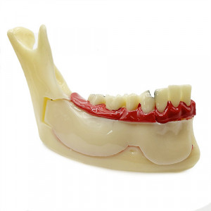 Model educational-mandibula sectionata cu diverse patologii