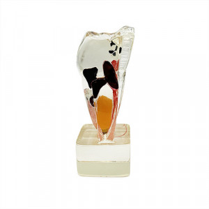 Model didactic patologii dentare YL-C17-01