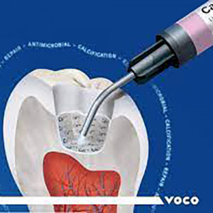 Calcimol LC hidroxid de calciu VOCO 2.5g.jpg