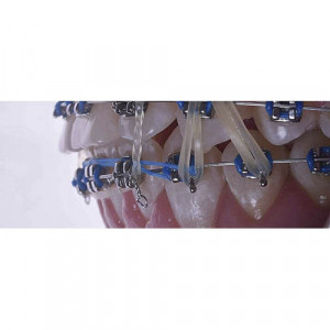 elastice intraorale ortodontice din latex.jpg