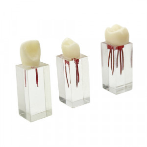 Endoblocuri transparent cu coroana YL-N5 3buc